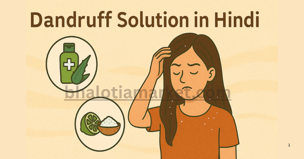 Dandruff Solution in Hindi