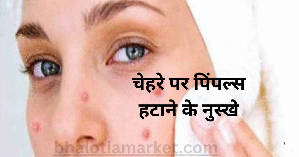 Pimple Kaise Thik Kare