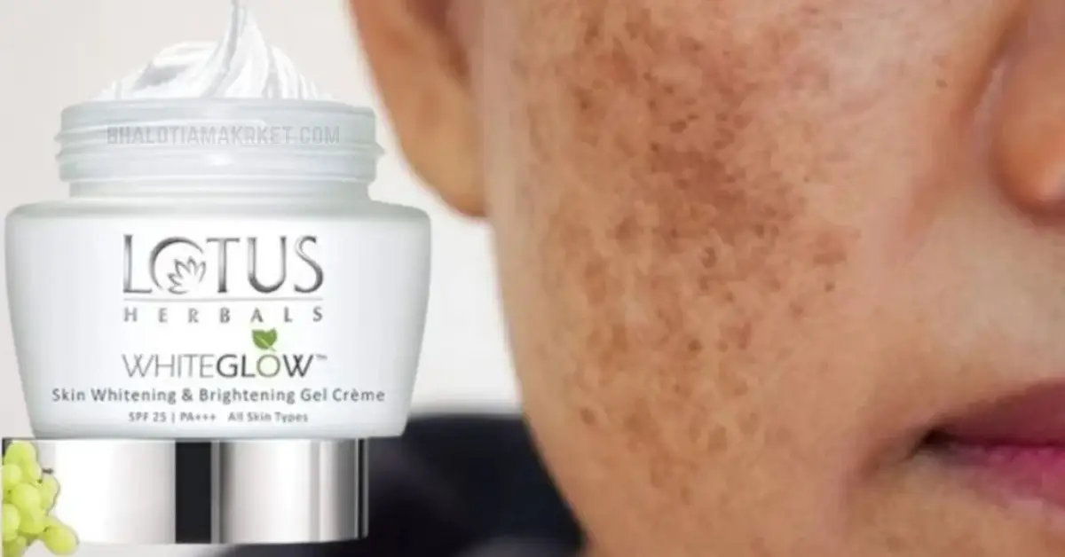 लोटस क्रीम के नुकसान